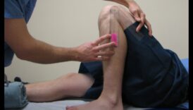 تنشيط التعافي: تقنيات إعادة التأهيل التقدمية